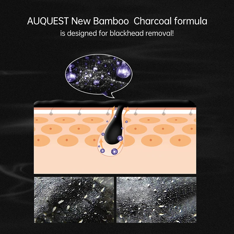 AuQuest Blackhead Treatment Peeling Mask