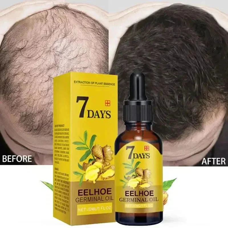 Fast Ginger Hair Growth Serum