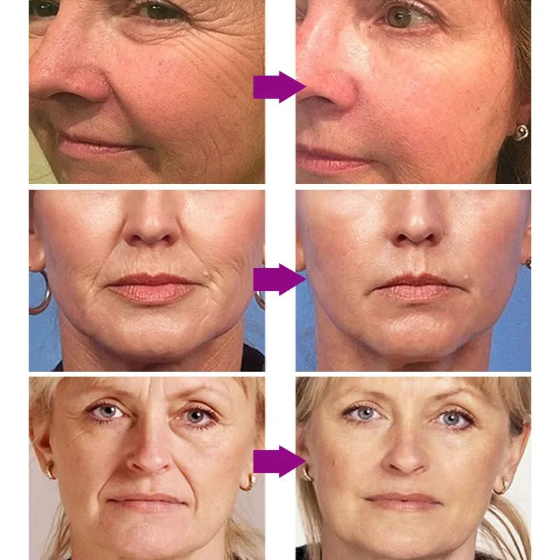 Retinol Wrinkle Remover Face Serum Instant Firming Lifting Anti-Aging