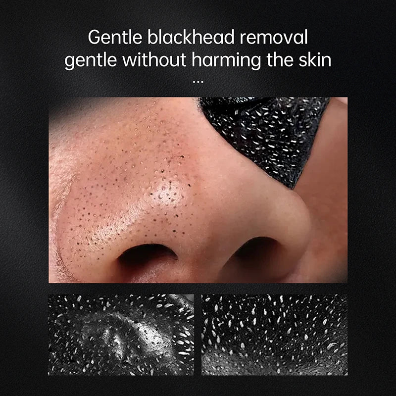 AuQuest Blackhead Treatment Peeling Mask