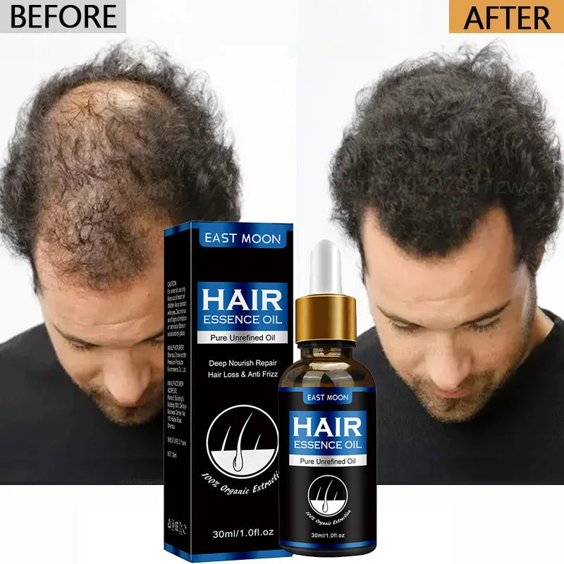Hair Growth Oil Effective Rapid Repair Baldness Hair Follicles Hereditary Hair Loss Postpartum Hair Loss Seborrheic Hair Care