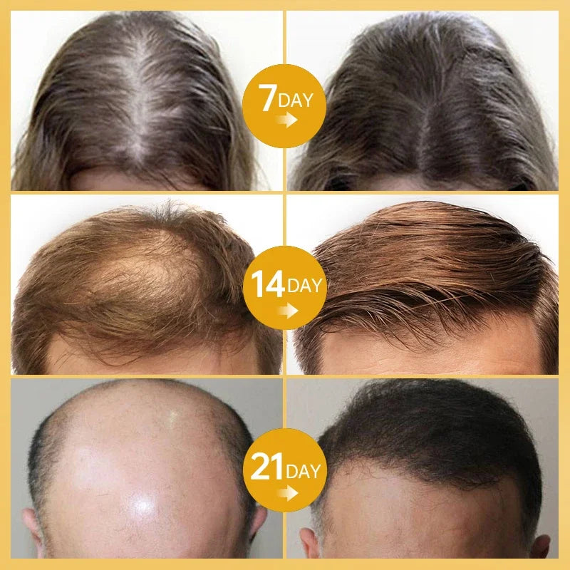 Fast Ginger Hair Growth Serum