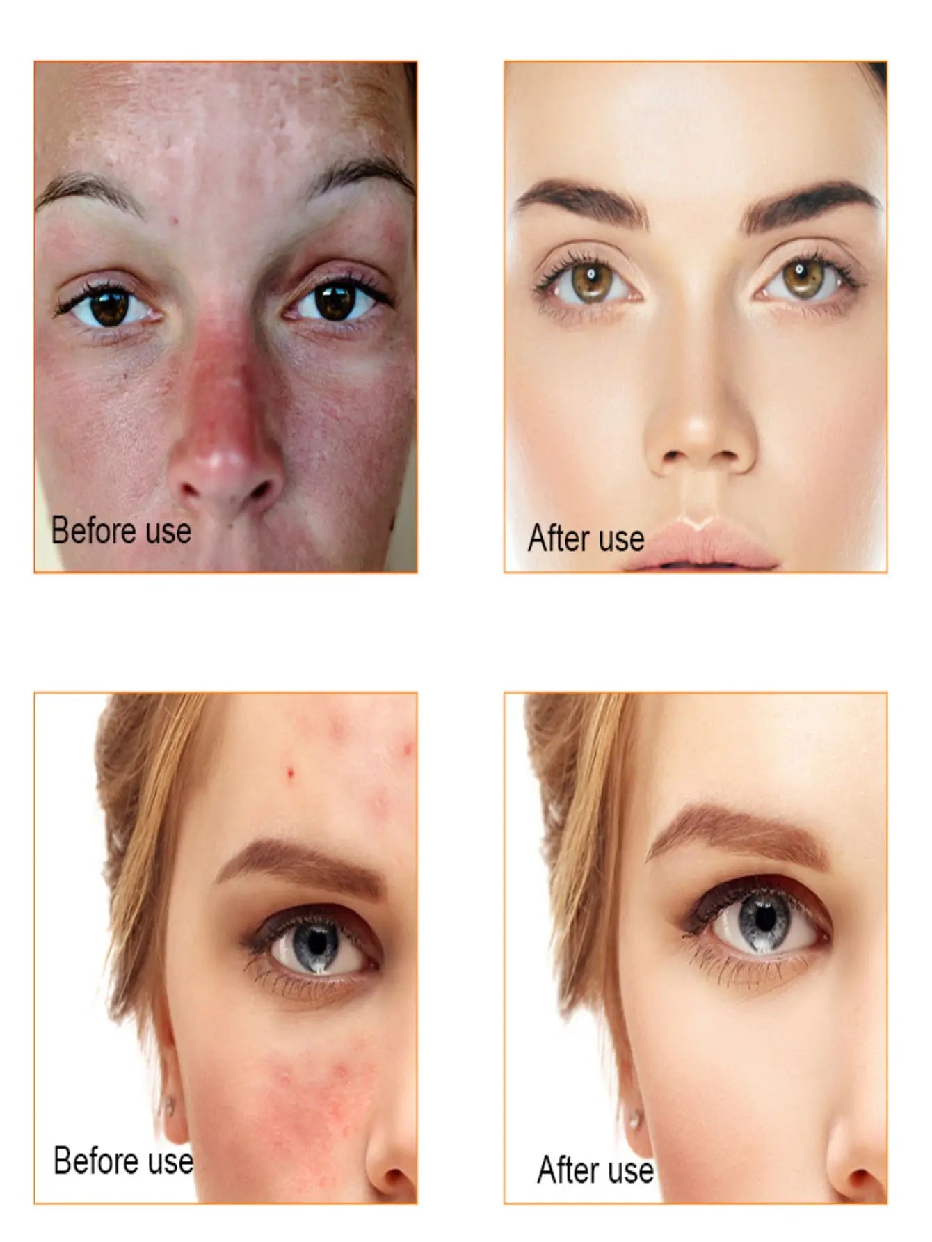 Vitamin C Serum For Face Moisturizing Brightens Skin Repair