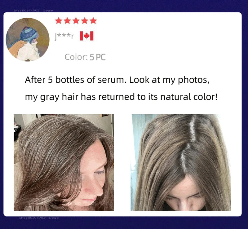 Black Hair Serum Anti Gray Hair Treatment Scalp Care Anti Hair Loss