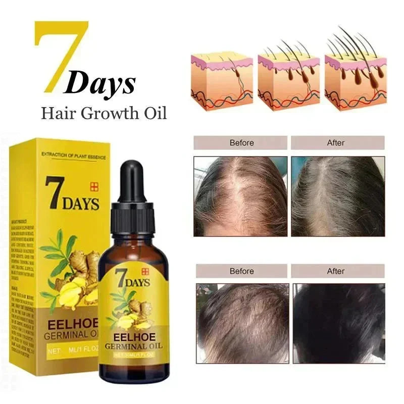 Fast Ginger Hair Growth Serum
