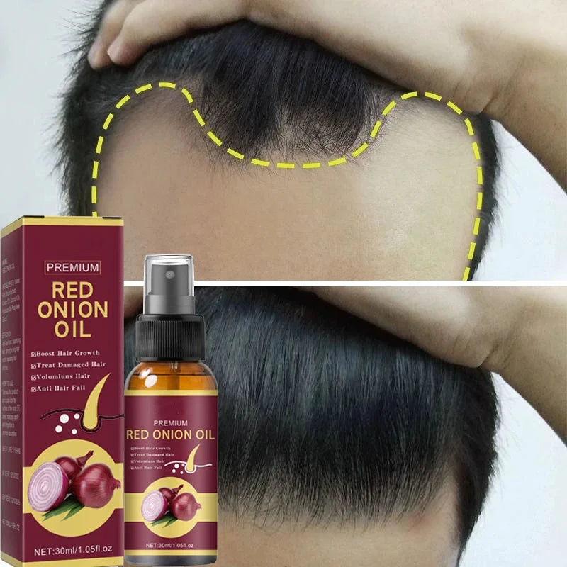 Powerful Hair Growth Spray
