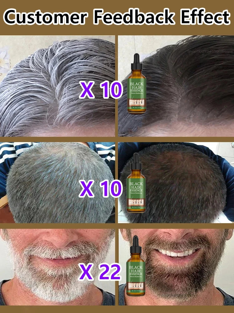 Black Hair Serum Anti Gray Hair Treatment Scalp Care Anti Hair Loss