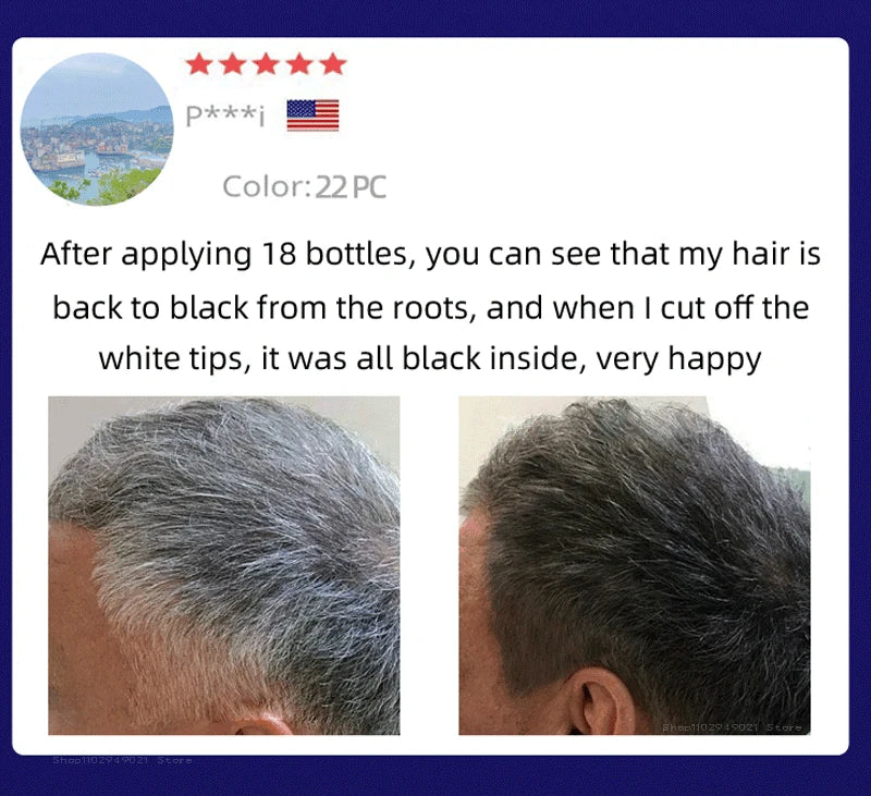 Black Hair Serum Anti Gray Hair Treatment Scalp Care Anti Hair Loss