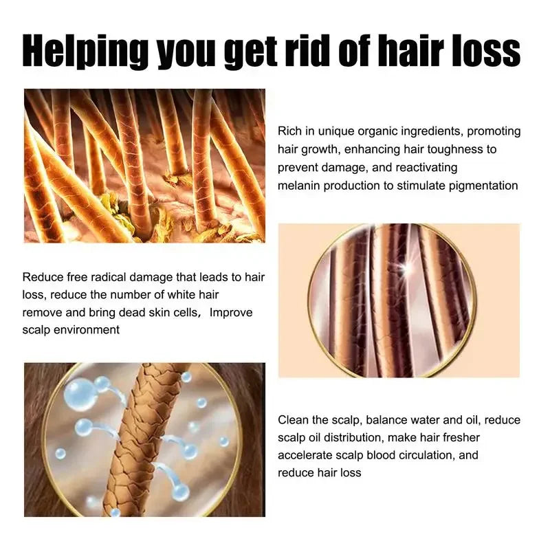 Hair Growth Oil Effective Rapid Repair Baldness Hair Follicles Hereditary Hair Loss Postpartum Hair Loss Seborrheic Hair Care