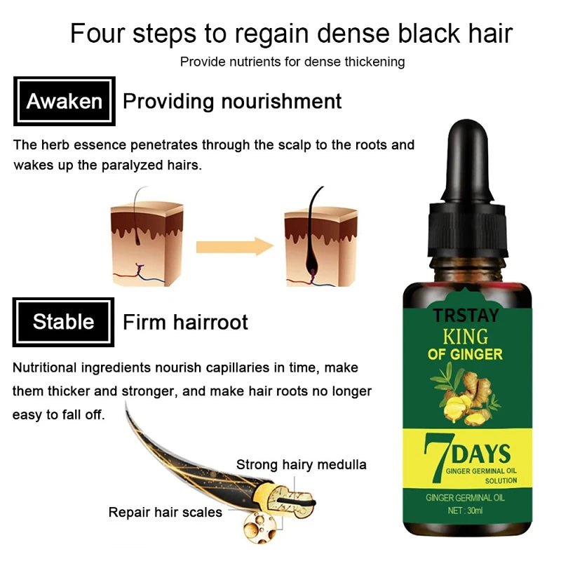 Ginger Hair Care Essential Oil 30ml Improves Scalp Environment Hair Loss Treatment