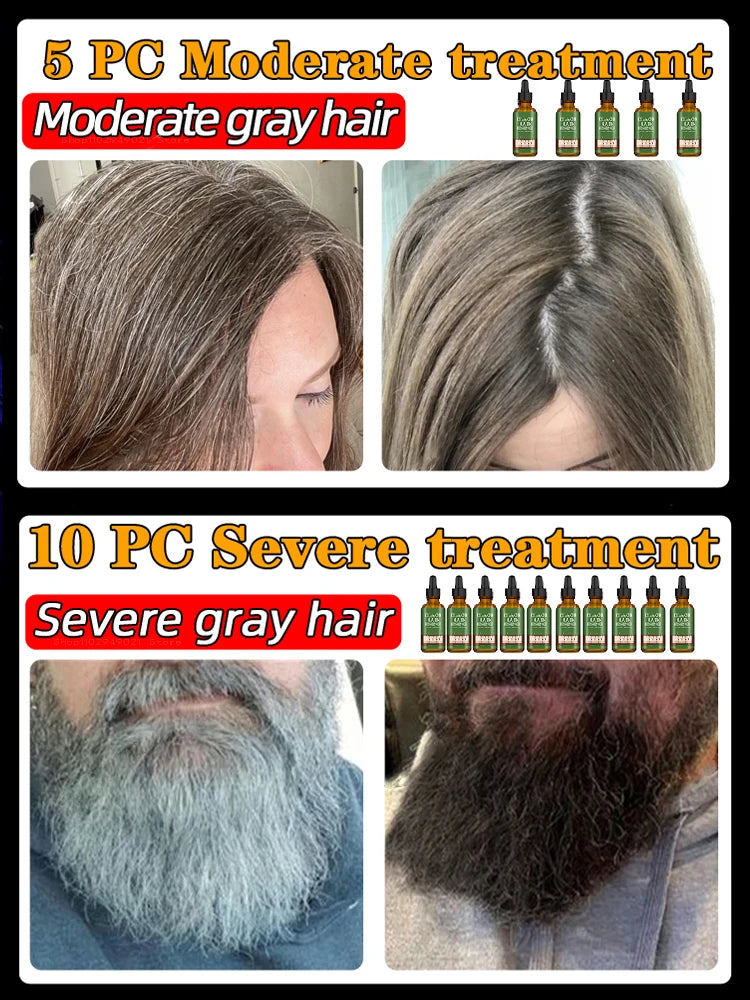 Black Hair Serum Anti Gray Hair Treatment Scalp Care Anti Hair Loss