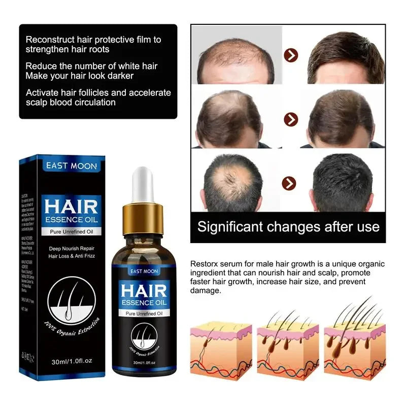 Hair Growth Oil Effective Rapid Repair Baldness Hair Follicles Hereditary Hair Loss Postpartum Hair Loss Seborrheic Hair Care