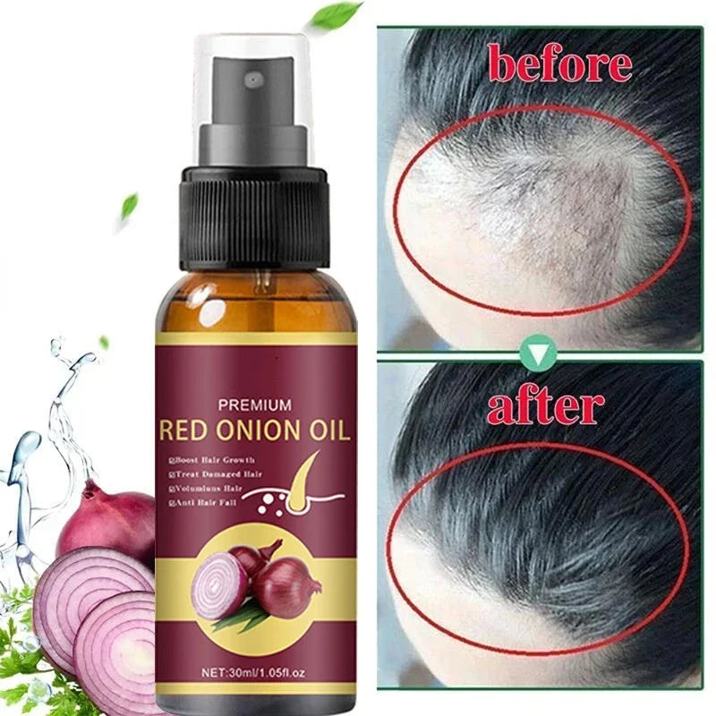 Powerful Hair Growth Spray