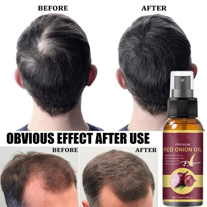 Powerful Hair Growth Spray