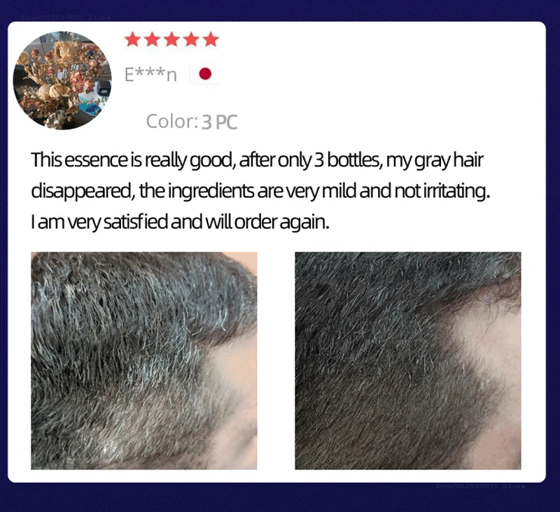 Black Hair Serum Anti Gray Hair Treatment Scalp Care Anti Hair Loss