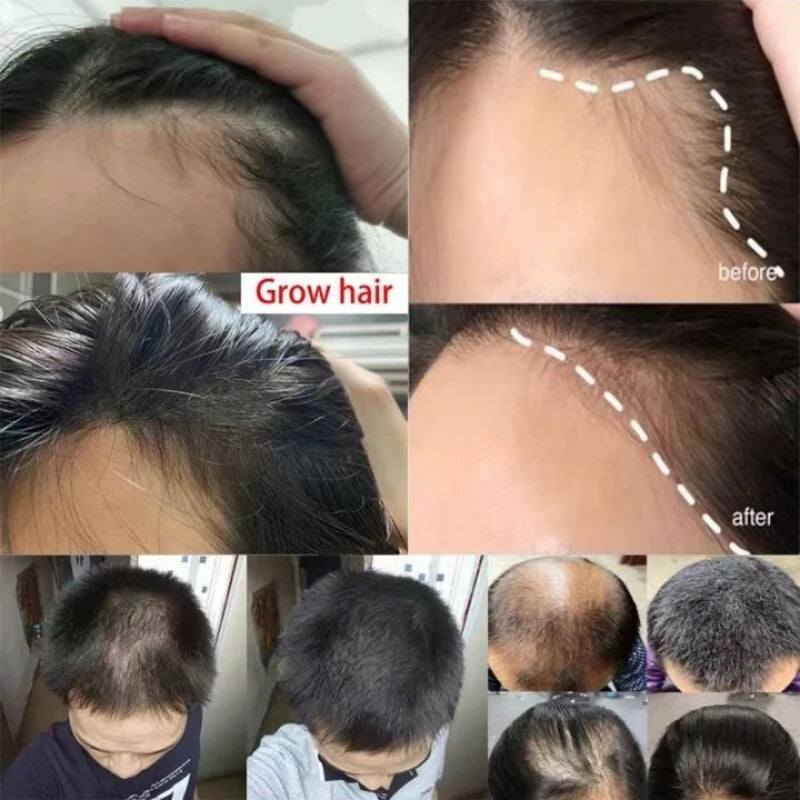 Powerful Hair Growth Spray