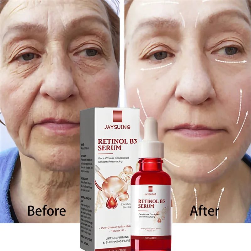 Retinol Wrinkle Remover Face Serum Instant Firming Lifting Anti-Aging
