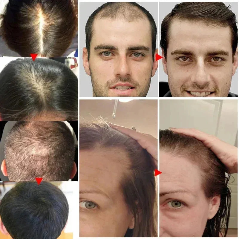Hair Growth Spray Products